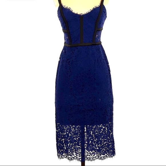 Express Dresses & Skirts - Express lace dress size 4